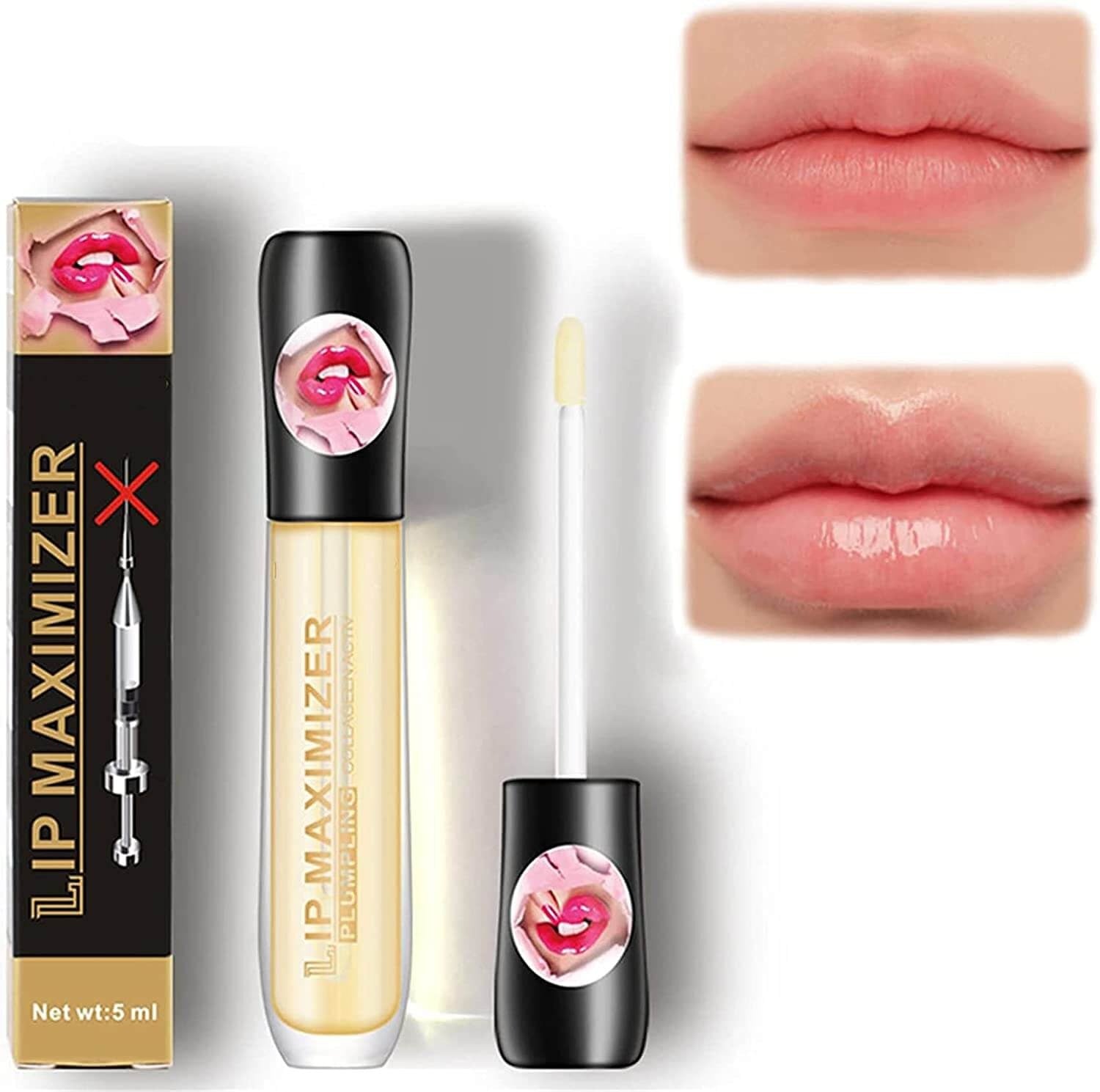 Kiss Beauty™ - Lippen-Maximierer